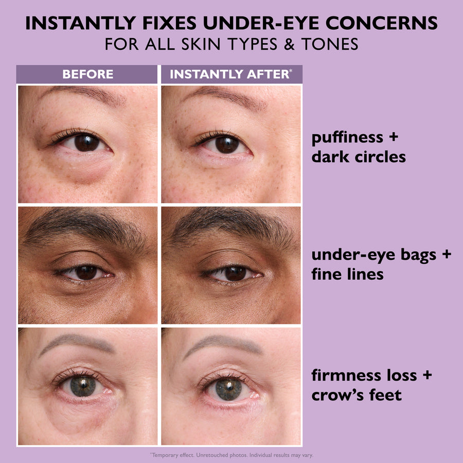 Last 3 Hours:🔥 Up to 15% OFF – Instant Eye Tightener Easy-Wear Formula